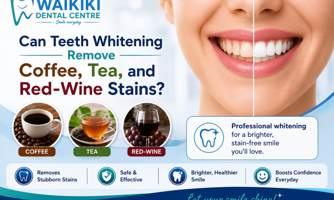 Teeth Whitening Treatment- Remove Coffee, Tea, and Red-Wine Stains