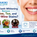 Teeth Whitening Treatment- Remove Coffee, Tea, and Red-Wine Stains