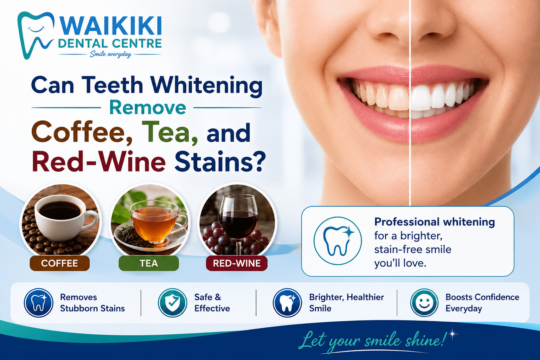 Teeth Whitening Treatment- Remove Coffee, Tea, and Red-Wine Stains
